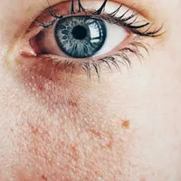 Ce trebuie să conţină crema de protecţie solară ca să prevină cancerul - Foto: Pexels/Almada Studio