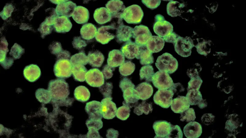 Un american a fost ucis de Ameba Naegleria, care mănâncă creierul _ Foto: Sky News
