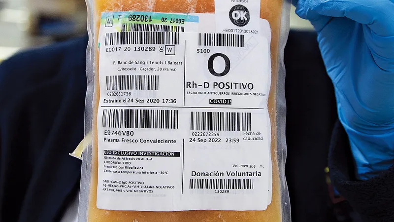 Plasmă de sânge înghețată de la donator COVID-19