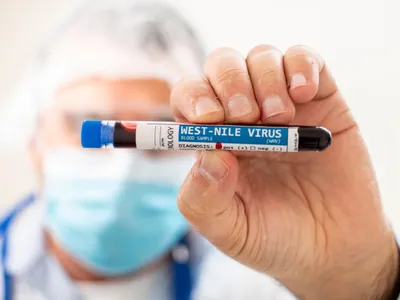 Virusul West Nile - Foto: Profimedia images