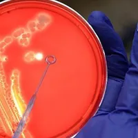 În contextul pandemiei de Covid, SUA cer consolidarea Convenției privind armele biologice/foto: yahoo