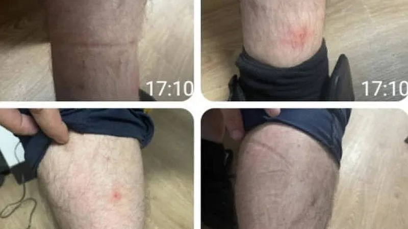 Poliţişti muşcaţi de ploşniţe, la Poliţia Capitalei - Foto: Sindicatul Europol