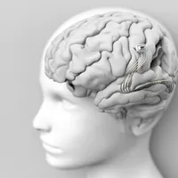 Neuralink, start-up-ul lui Elon Musk, a implantat primul microcip în creierul unui om - Foto: Profimedia Images - Rol ilustrativ