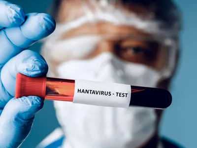 Hantavirus - Foto: Profimedia images