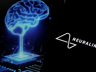 Neuralink - Foto: Profimedia images