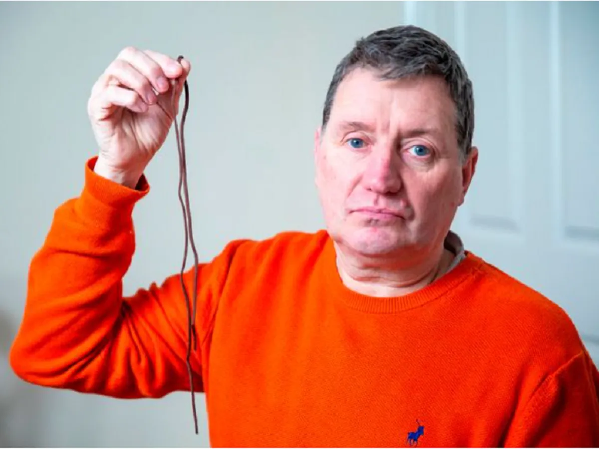 Britanicii își scot singuri dinții și măselele.folosind șireturile de la pantofi - Foto: Adam Gerrard / Daily Mirror
