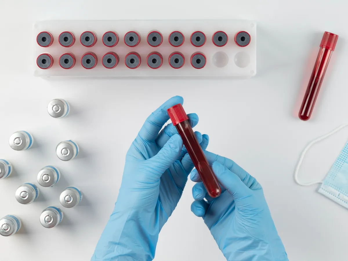 Sânge Foto: Freepik  (imagine cu rol ilustrativ)