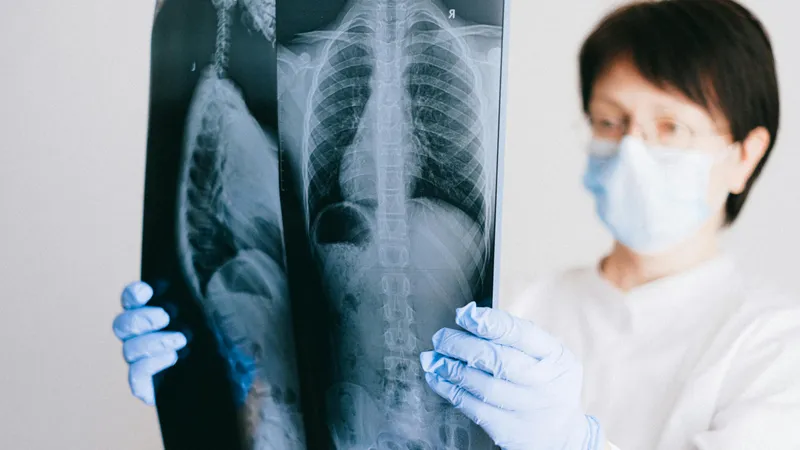 9 din 10 persoane din lume respiră aer poluat. Cum ne afectează sănătatea? Foto: Pexels (fotografie cu caracter ilustrativ)