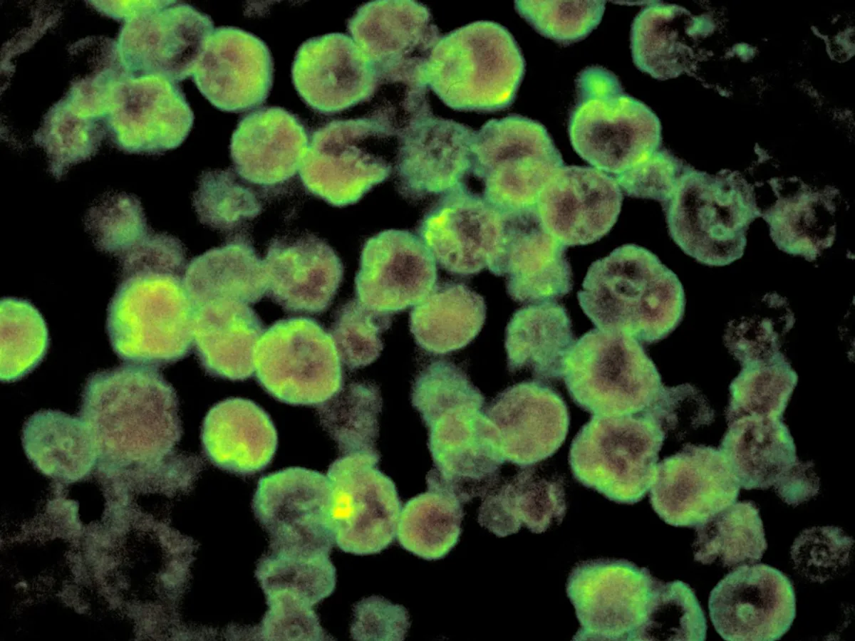 Un american a fost ucis de Ameba Naegleria, care mănâncă creierul _ Foto: Sky News