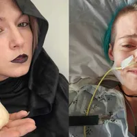 „Boala vampirilor”, metoda prin care o femeie poate muri dacă mănâncă usturoi. Ce o declanșează? - Foto: Profimedia Images (imagine cu rol ilustrativ)