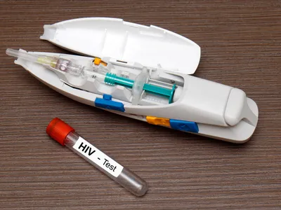 Test HIV - Foto: Profimedia images
