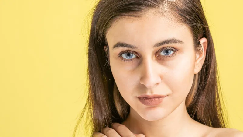 Cearcănele nu sunt doar semn de oboseală. Ce alte afecțiuni pot ascunde? - Foto: Freepik (rol ilustrativ)