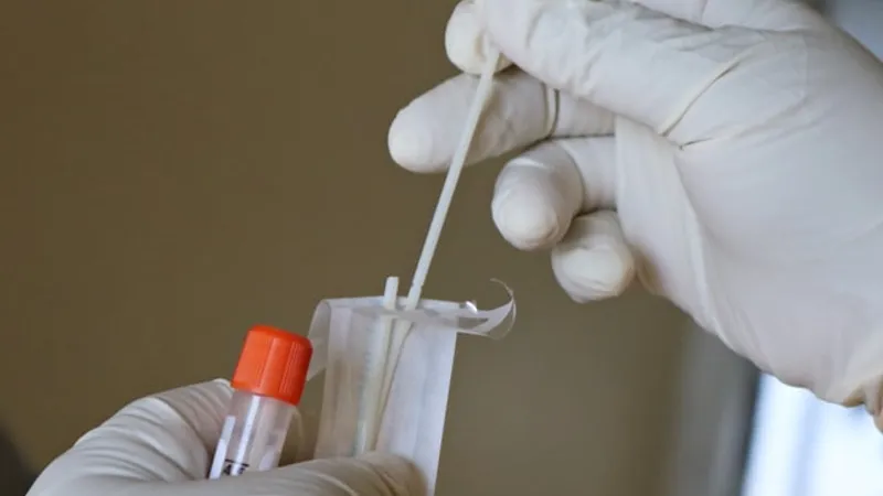 În 106 farmacii din țară se testează gratuit pentru COVID-19, 12 dintre ele în București/FOTO: Unsplash