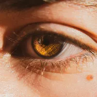 Descoperire revoluționară: retina, un indicator timpuriu pentru diabet și demență: FOTO - Profimedia(imagine cu rol ilustrativ)