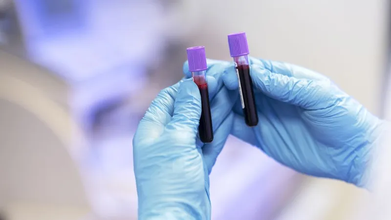Medic comparând două probe de sânge - Foto: Freepik/CC0