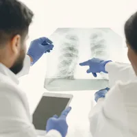Femeile nefumătoare, rată crescută de cancer pulmonar. Bărbații nu sunt afectați. Cauzele, un mister - Foto: Freepik (Imagine cu rol ilustrativ)
