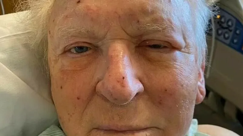 Un bărbat în vârstă de 81 de ani a agonizat timp de trei ore după ce a fost atacat de peste 200 de albine Foto: GOFUNDME.COM