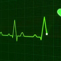 Numărul deceselor din cauză cardiovasculară, de trei ori mai mare în România față de media europeană. / Foto: ehealthromania.com