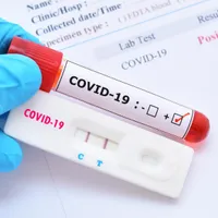 UK nu mai cere confirmarea prin test PCR a rezultatului pozitiv furnizat de un test COVID rapid. / Foto: cz.usembassy.gov