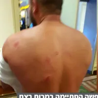 Unul din turiștii israelieni bătuți Foto: facebook, captură post TV