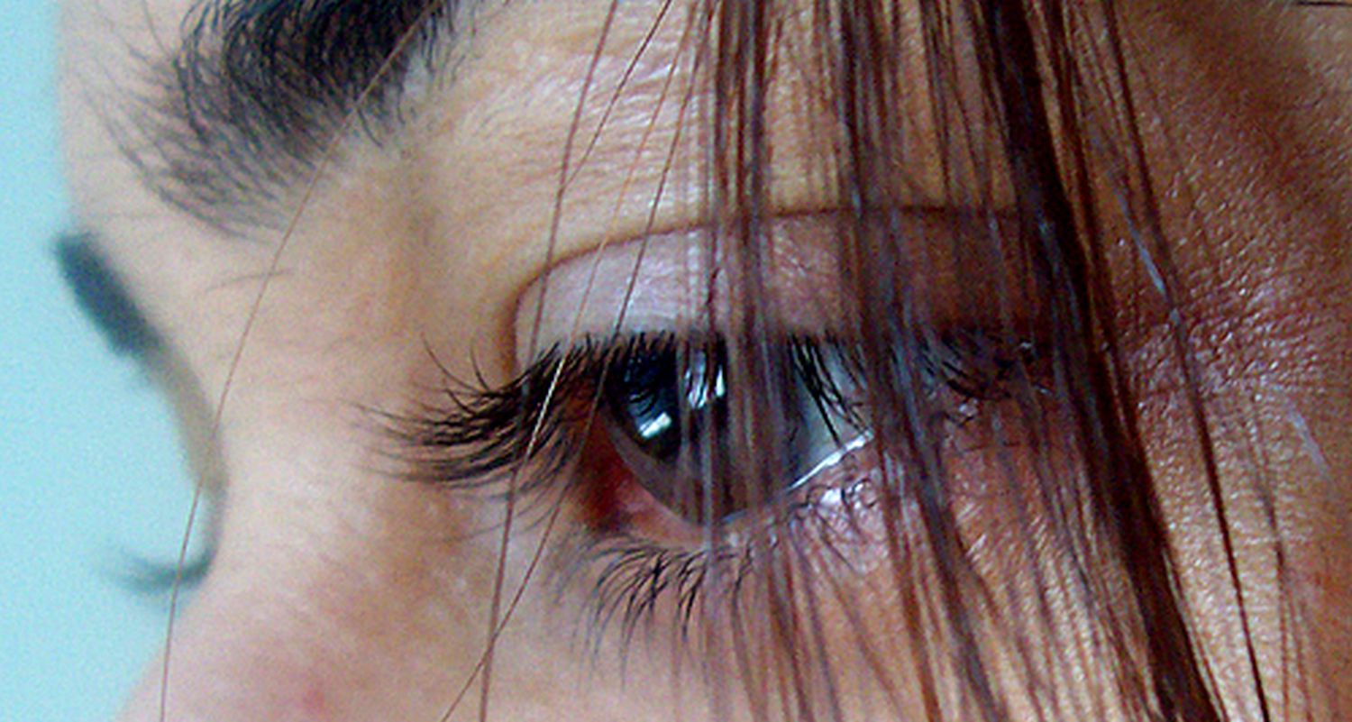 "Lacrimile artificiale" ale unei companii pharma dăunează grav sănătăţii. Duc la orbire şi deces - Foto: Flickr/Nisha A