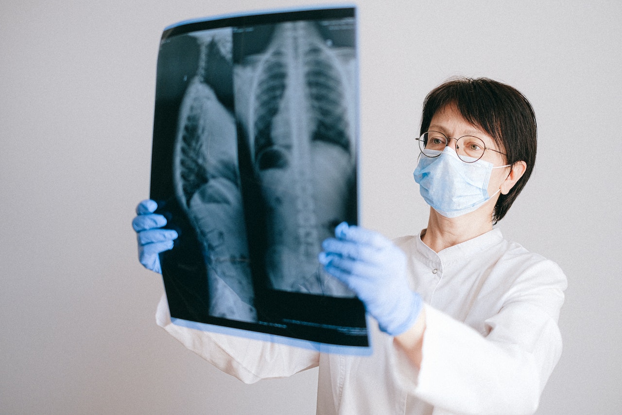 Medicii au văzut ceva suspect la radiografie (foto cu caracter ilustrativ) Foto: pexels.com