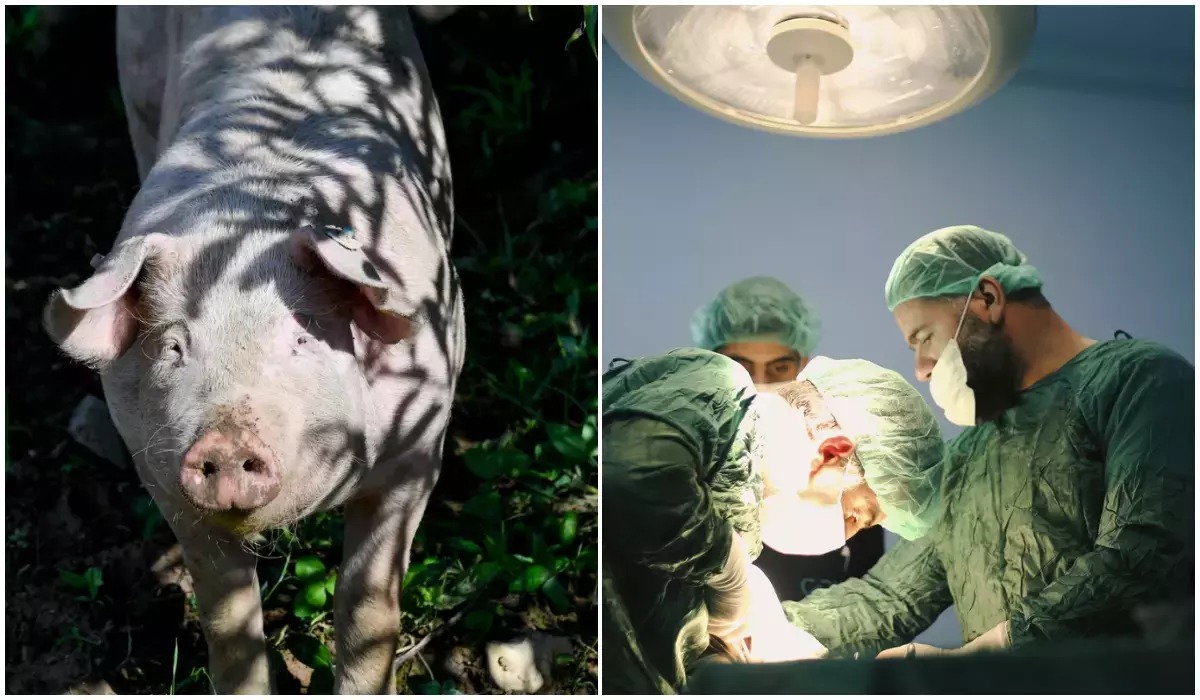 Un plămân de porc transplantat la un pacient aflat în moarte cerebrală. Cum a mers? - Foto: Arhiva